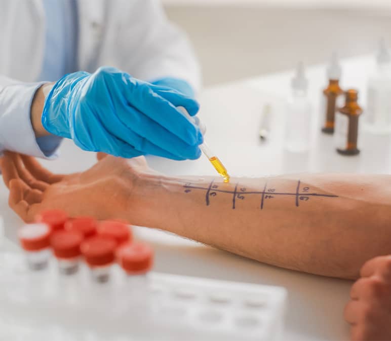 Allergy Testing,