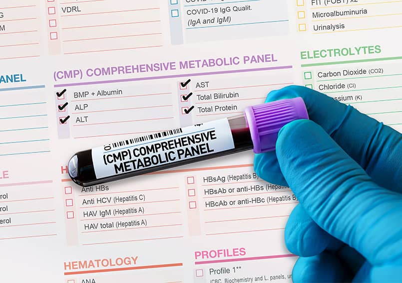 Metabolic Assessment,