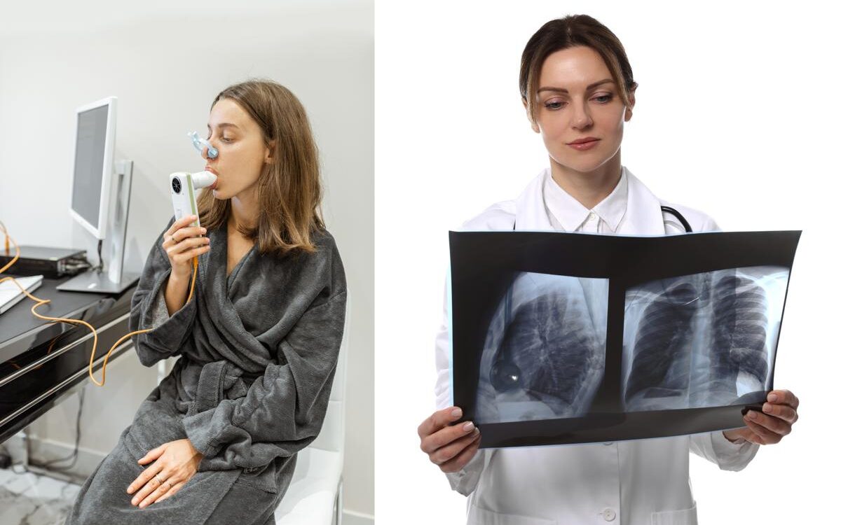 Pulmonary Function Test vs Chest X-Ray Comparison