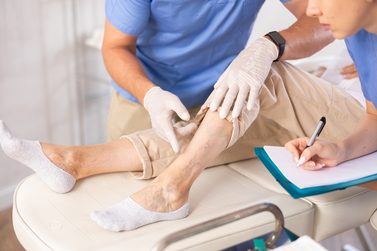 Physician performing vein treatment in Hackensack NJ examining patient leg with visible varicose veins during clinical evaluation